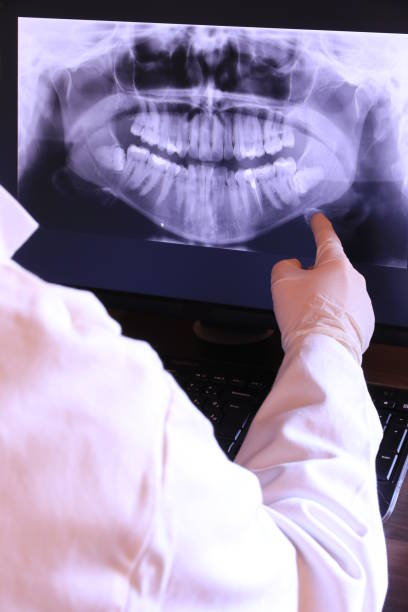 Emergency Dental Filling Replacement in WY